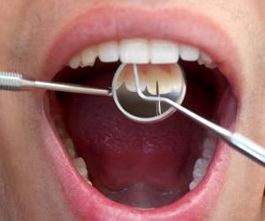 Dental Exam Close Up
