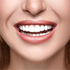 Dental Veneers Are For Everyday<br>People Like You Dental Veneers Are For Everyday People Like You